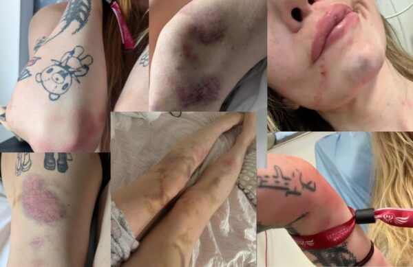 Jandarmeria Capitalei, după acuzațiile privind agresarea unei femei într-o secție de poliție: Nu am primit nicio plângere